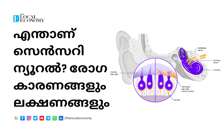 Sensorineural