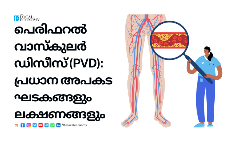 Illustration of blocked arteries due to Peripheral Vascular Disease (PVD) caused by cholesterol buil